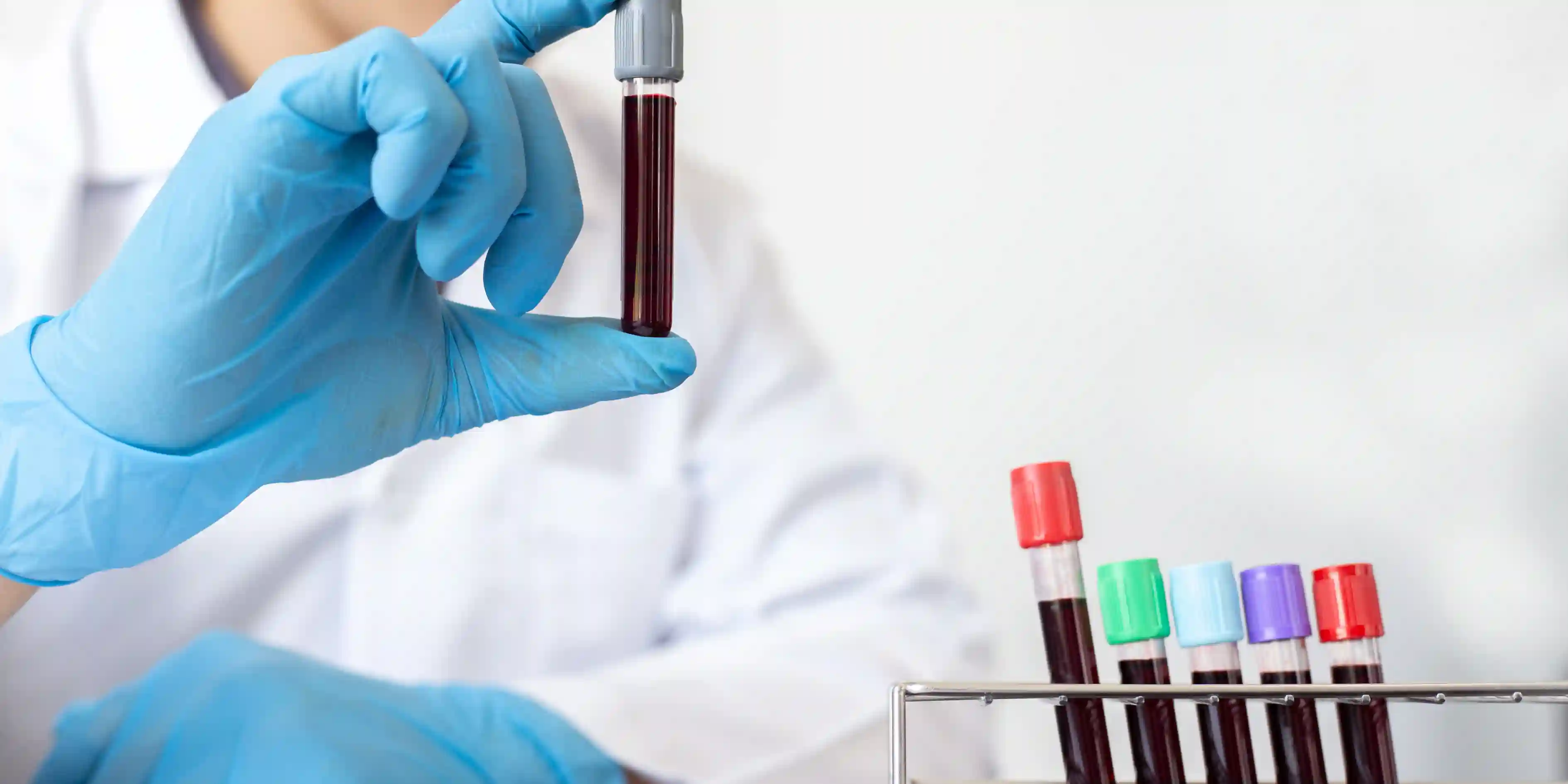 Blood Test